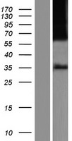 Mu Opioid Receptor (OPRM1) Human Over-expression Lysate