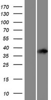 TCP10L2 Human Over-expression Lysate