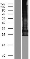 TMEM247 Human Over-expression Lysate