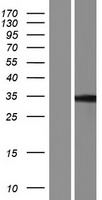 PPHLN1 Human Over-expression Lysate