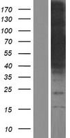 CoCoA (CALCOCO1) Human Over-expression Lysate