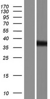 Tropomodulin 2 (TMOD2) Human Over-expression Lysate