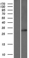 RAB34 Human Over-expression Lysate