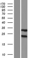 GSTM2 Human Over-expression Lysate