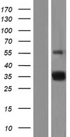 TARM1 Human Over-expression Lysate