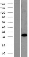 RABL2B Human Over-expression Lysate
