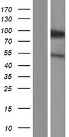 KIFC3 Human Over-expression Lysate