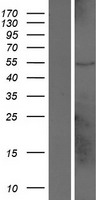 DUX4L7 Human Over-expression Lysate