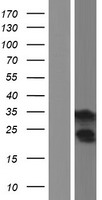 Troponin T1 (TNNT1) Human Over-expression Lysate