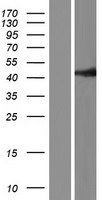 p53 (TP53) Human Over-expression Lysate