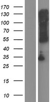 TMEM72 Human Over-expression Lysate