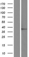 JMJD7 Human Over-expression Lysate