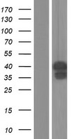 Fos B (FOSB) Human Over-expression Lysate