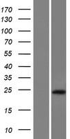 LINC02693 Human Over-expression Lysate