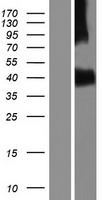 Activin A Receptor Type IC (ACVR1C) Human Over-expression Lysate