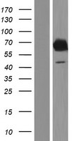 EBF4 Human Over-expression Lysate