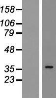 hnRNP A2B1 (HNRNPA2B1) Human Over-expression Lysate