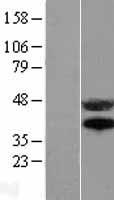 CD95 (FAS) Human Over-expression Lysate