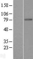 Butyrylcholinesterase (BCHE) Human Over-expression Lysate