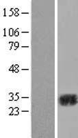 Carbonic Anhydrase II (CA2) Human Over-expression Lysate