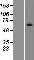 Complement factor 8 beta (C8B) Human Over-expression Lysate