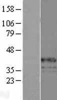 glucose 6 phosphatase, catalytic subunit (G6PC) Human Over-expression Lysate
