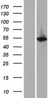 Keratin 12 (KRT12) Human Over-expression Lysate