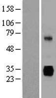 gamma Sarcoglycan (SGCG) Human Over-expression Lysate