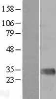Mannan Binding Lectin (MBL2) Human Over-expression Lysate