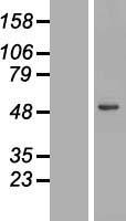 Lysosomal acid lipase (LIPA) Human Over-expression Lysate