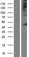P protein (OCA2) Human Over-expression Lysate
