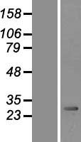 PMM2 Human Over-expression Lysate