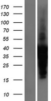 Cardiac Troponin I (TNNI3) Human Over-expression Lysate