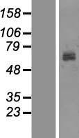 Tyrosinase (TYR) Human Over-expression Lysate