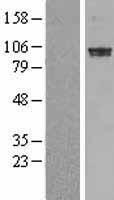 PDE6 alpha (PDE6A) Human Over-expression Lysate