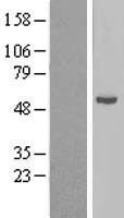 CYP21A2 Human Over-expression Lysate