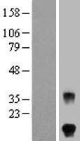 FSH beta (FSHB) Human Over-expression Lysate