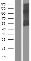 IL5RA Human Over-expression Lysate