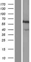 Osteopontin (SPP1) Human Over-expression Lysate