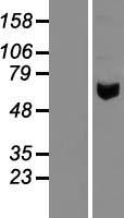 Pancreatic alpha amylase (AMY2A) Human Over-expression Lysate