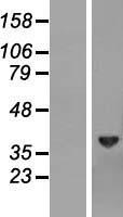 Biliverdin Reductase (BLVRA) Human Over-expression Lysate