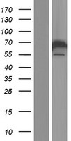 CACNB1 Human Over-expression Lysate
