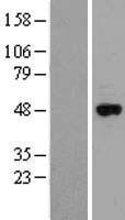 Cytochrome p450 2J2 (CYP2J2) Human Over-expression Lysate