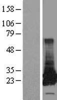 Glutathione S Transferase theta 2 (GSTT2) Human Over-expression Lysate