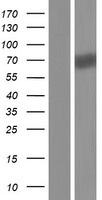 IL1 Receptor I (IL1R1) Human Over-expression Lysate