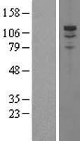 PDE3A Human Over-expression Lysate