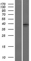 EP2 (PTGER2) Human Over-expression Lysate