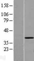 GMPR2 Human Over-expression Lysate