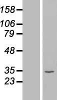 ATP5F1C Human Over-expression Lysate