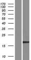 EXOSC3 Human Over-expression Lysate